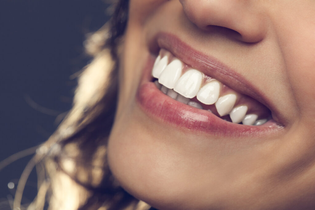 teeth whitening in Waco, TX, can help improve the look and feel of your smile