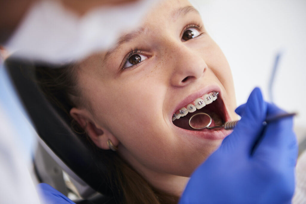 It’s more crucial than ever that patients with braces get regular dental cleanings in Waco, TX.