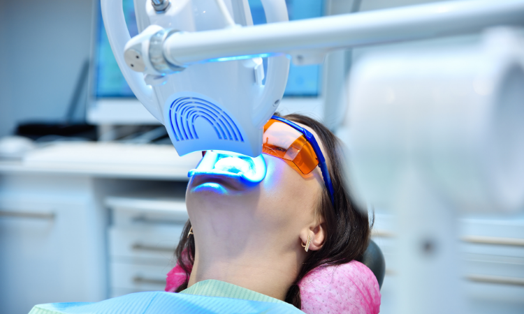 While store-bought options promise quick and low-cost results, professional teeth whitening offers numerous advantages.