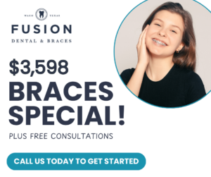 braces special