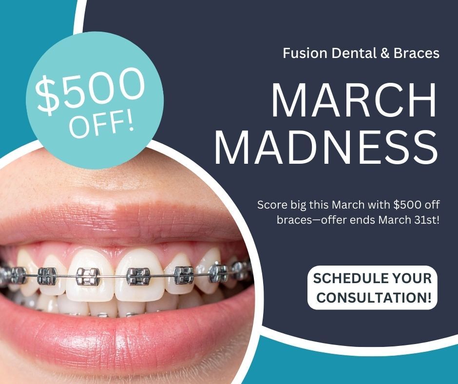 Fusion Dental & Braces - Hewitt - Orthodontist in Waco